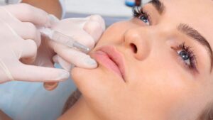The Art of the Perfect Pout: Everything You Need to Know About Lip Fillers